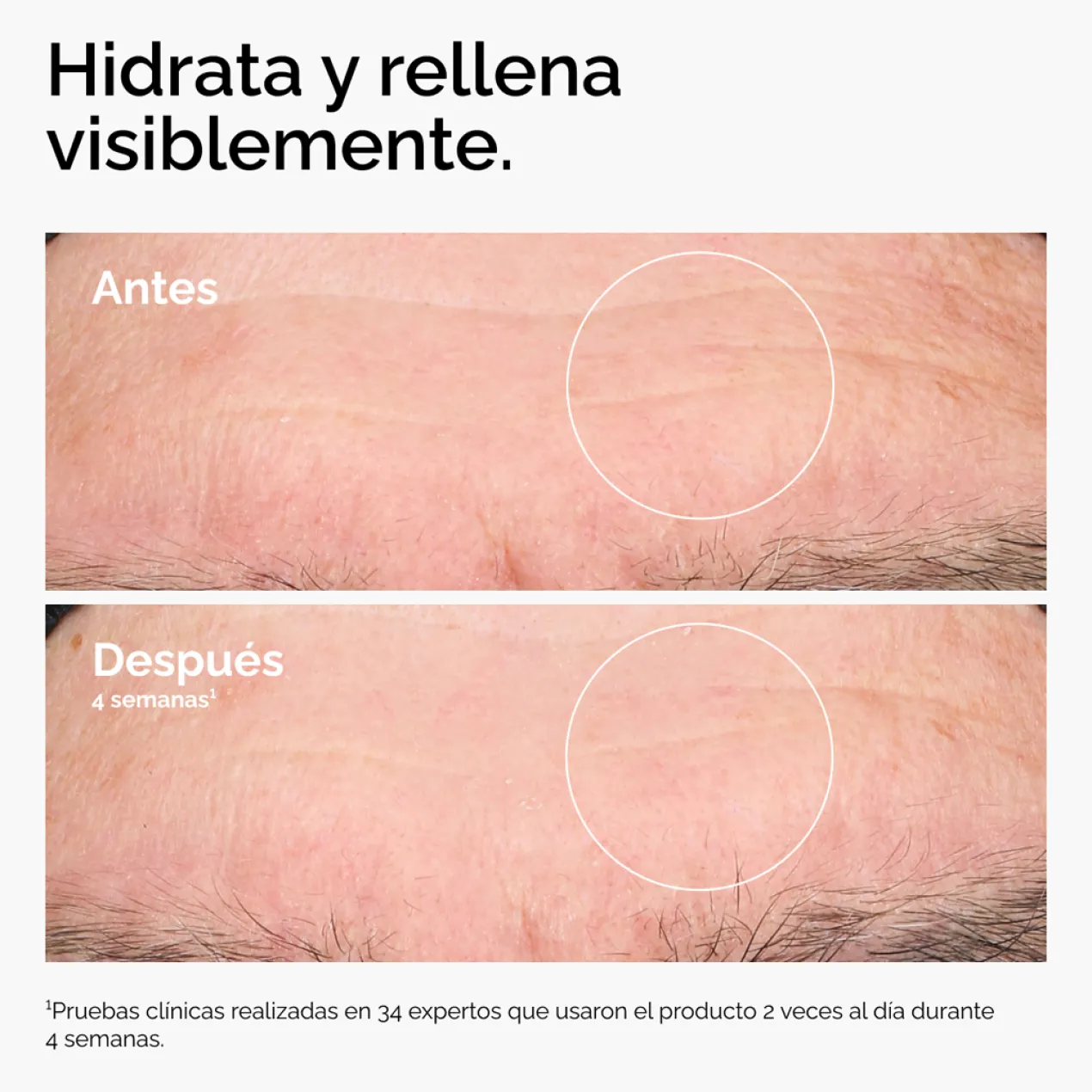 Acide Hyaluronique 2% + B5