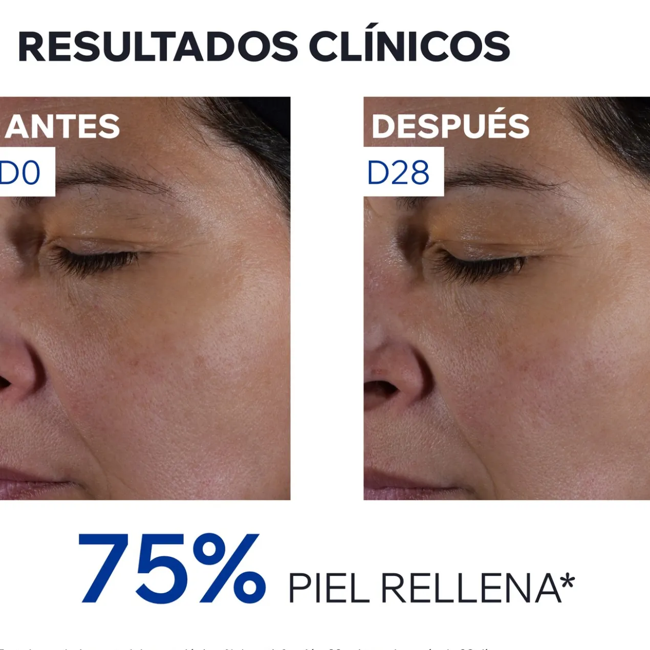 Age Absolu Crème Rose Redensifiante