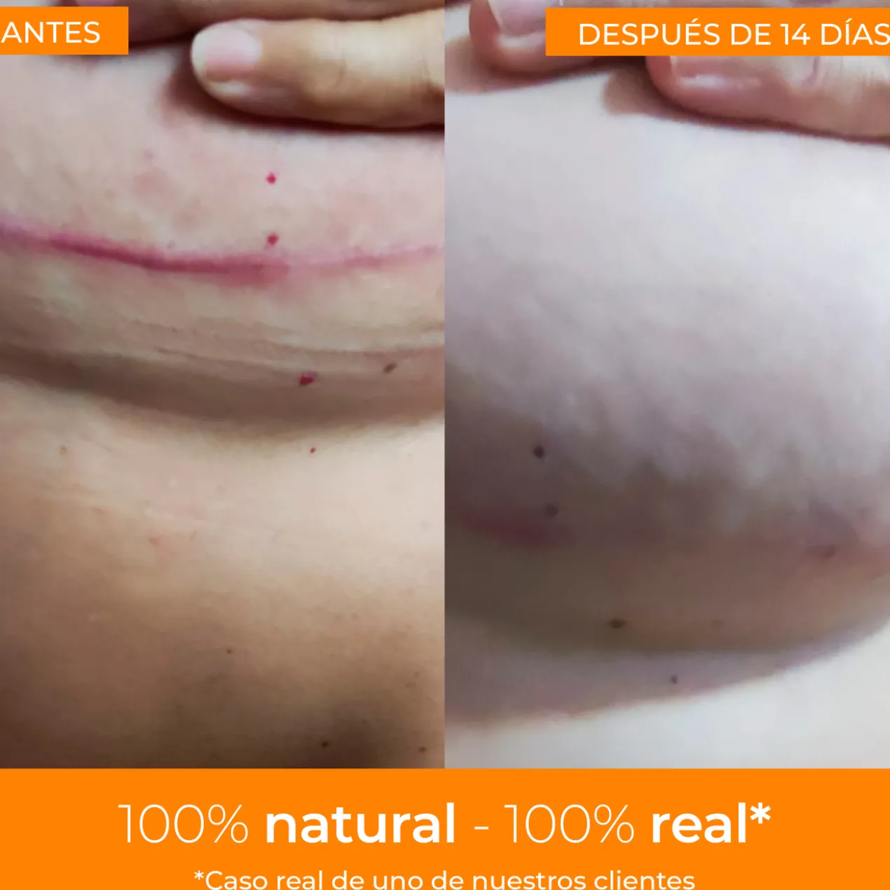 Boticream Crème Réparatrice