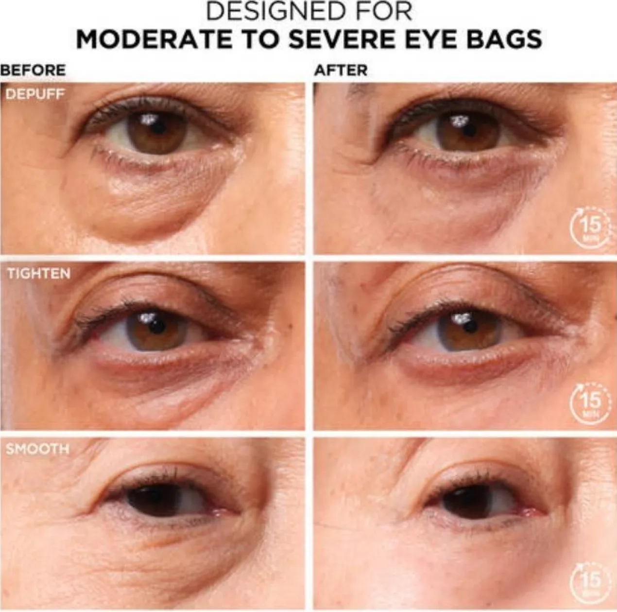 Bye Bye Under Eye Bag Traitement Anti-cernes