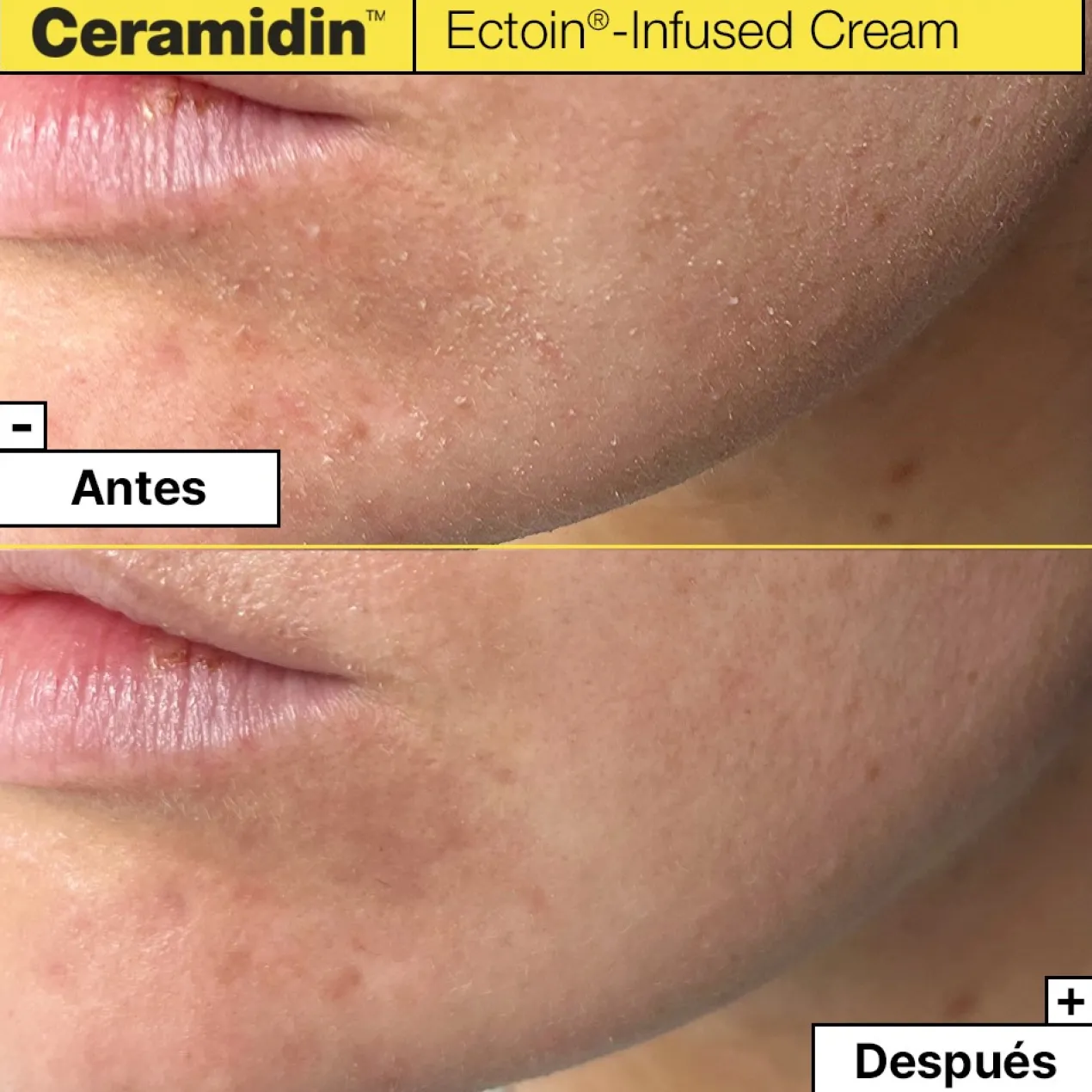Ceramidin Ectoin Infused Cream