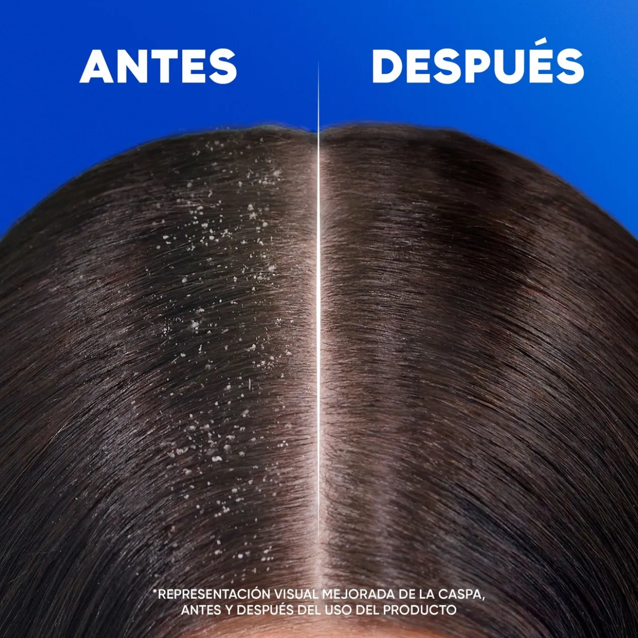 Citrus Fresh Shampoing Antipelliculaire