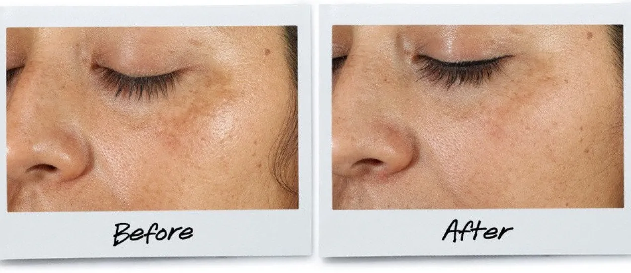 Clearly Corrective™ Dark Spot Solution - Sérum Éclaircissant Anti-Taches