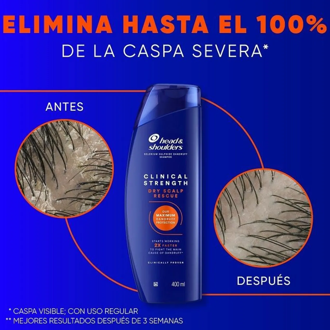 Clinical Strength Dry Scalp Rescue