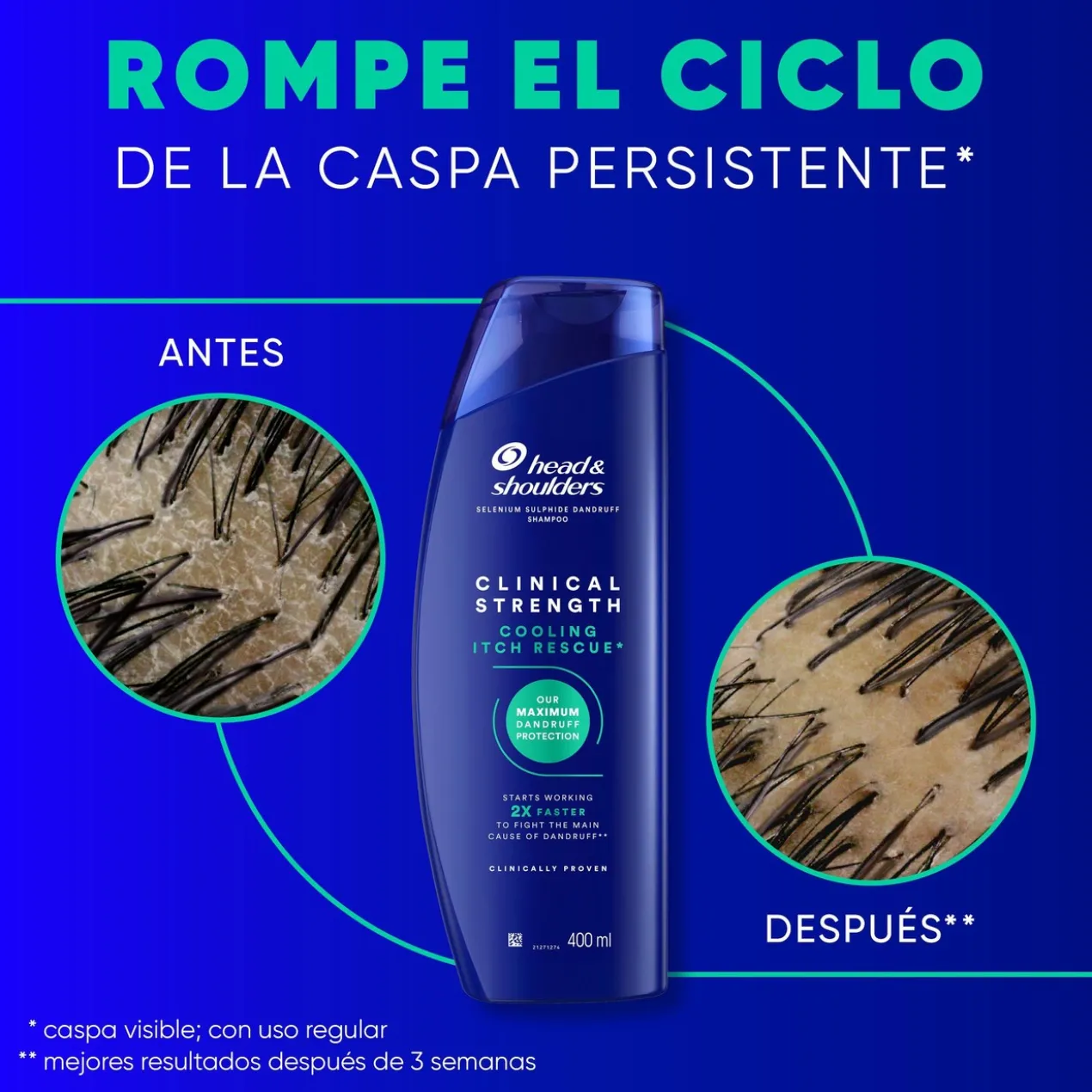 Clinical Strength Shampoing Soulagement des Démangeaisons