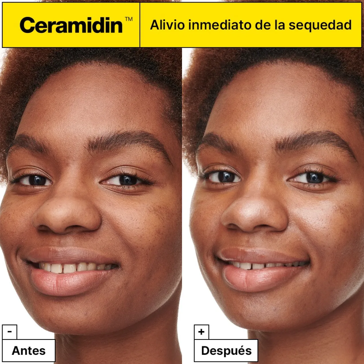 Céramidine Crème Hydratante