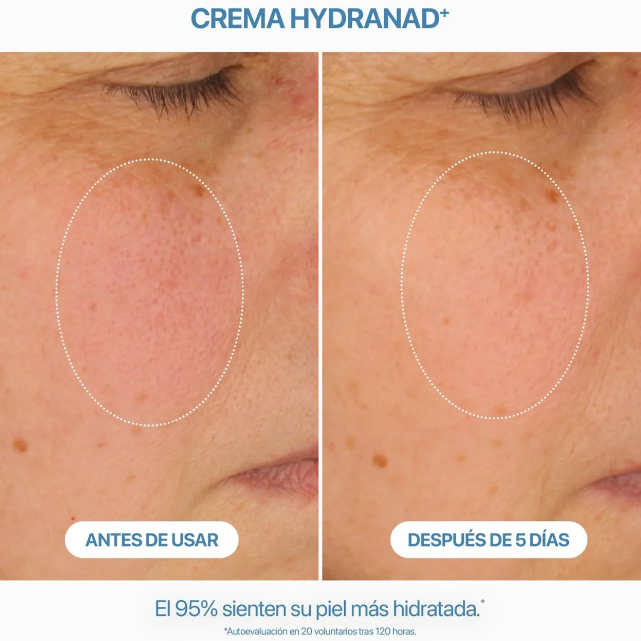 Crème Hydranad+