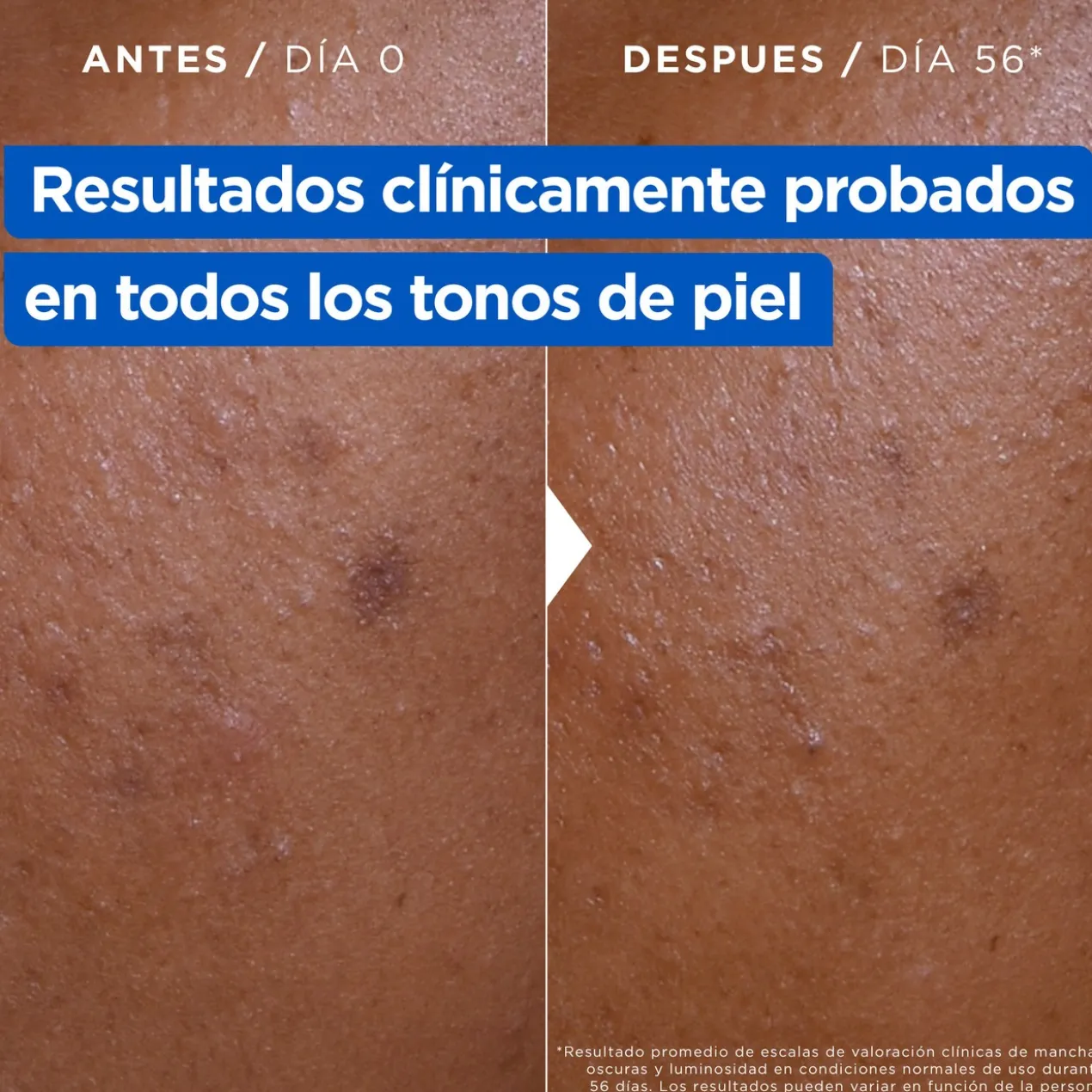 Crème hydratante anti-taches Niacidamide Bright