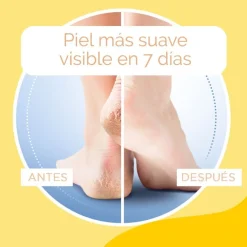 Crème Pieds Duretés