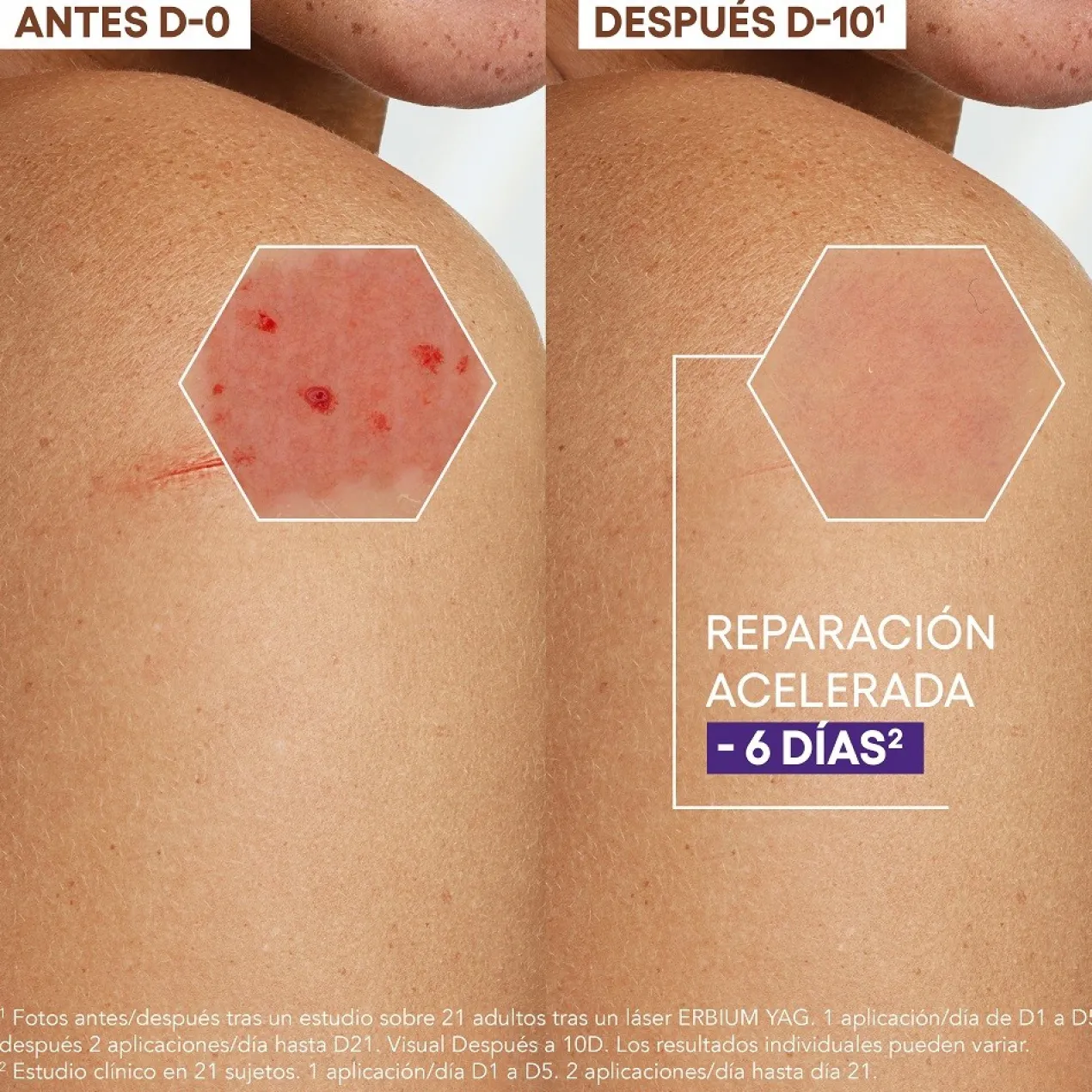 Crème Réparatrice Apaisante Epitheliale A.H Ultra