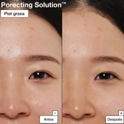 Dermask Porecting SolutionTM