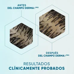 DermaXPro Shampoing Anti-pelliculaire Hydratant