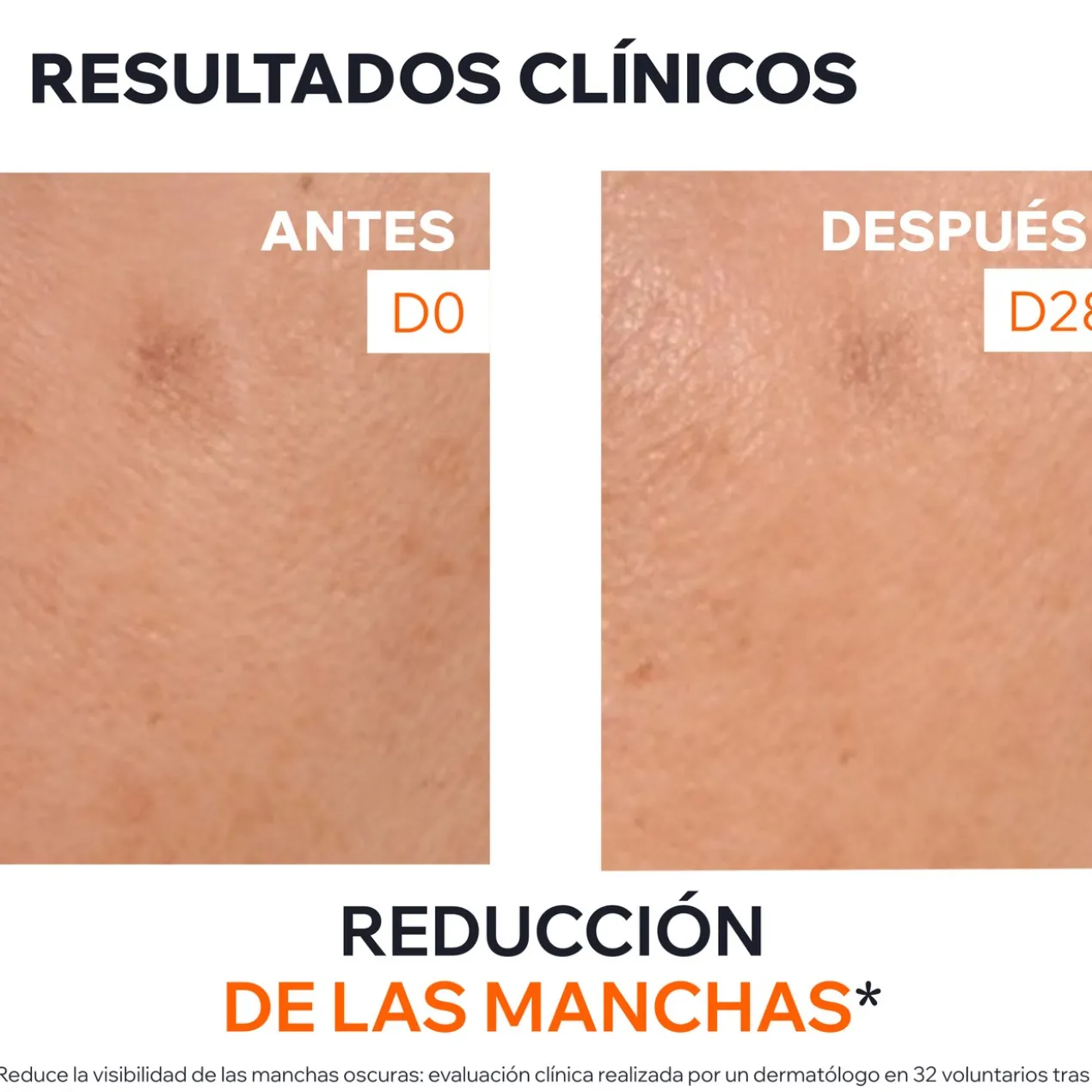 Dépiderm Sérum Anti-taches