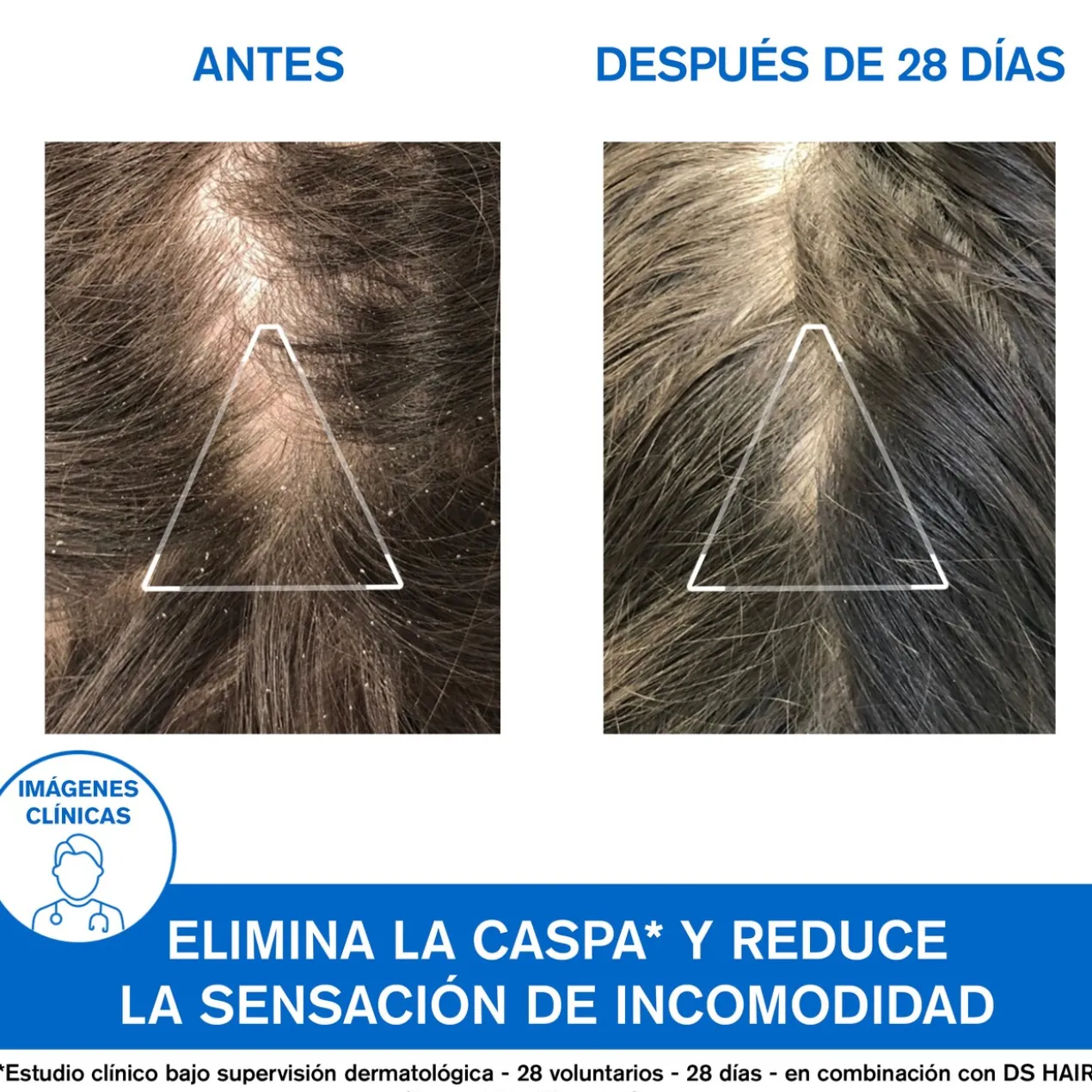 DS Hair Shampoing Anti-pelliculaire