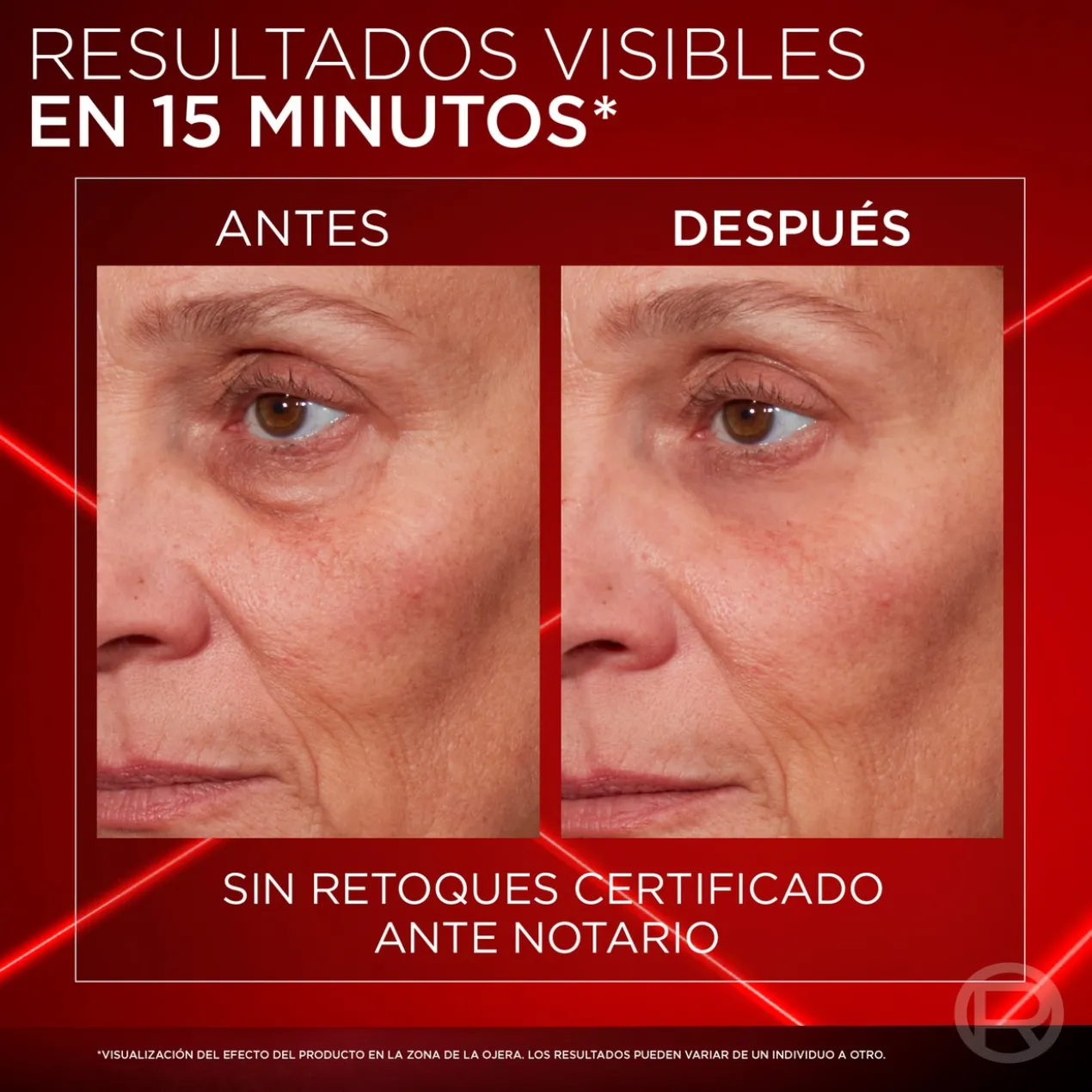 Effaceur Instantané de Poches Revitalift Laser
