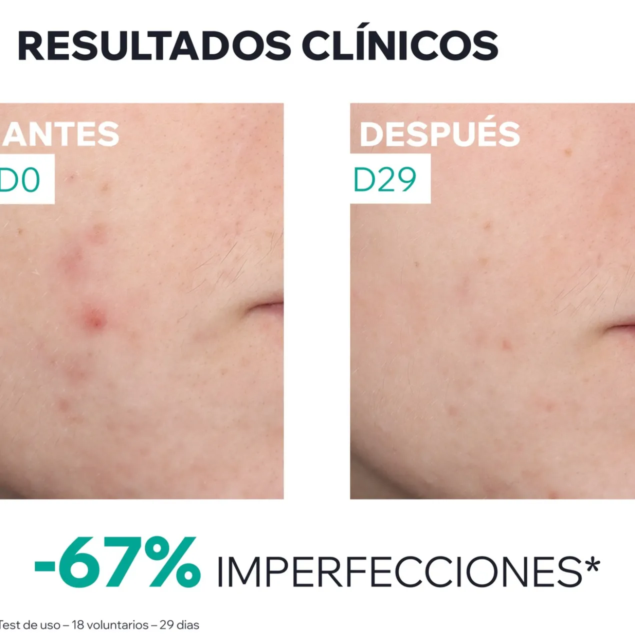 Hyseac Sérum Booster Anti-Imperfections