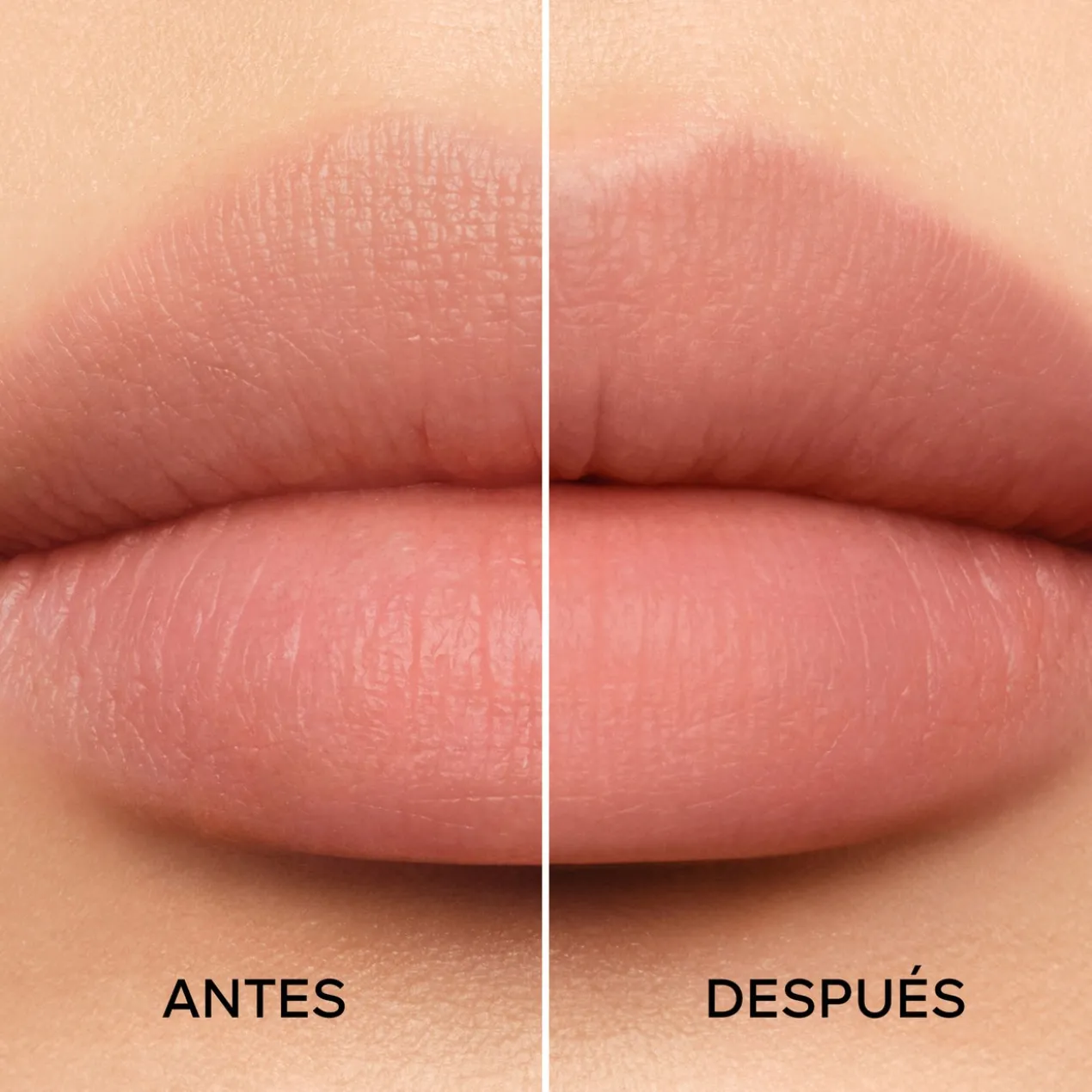 KissKiss Bee Lift Base de Traitement