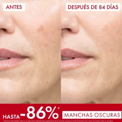 Liftactiv Pigment Specialist B3 Sérum Anti-taches