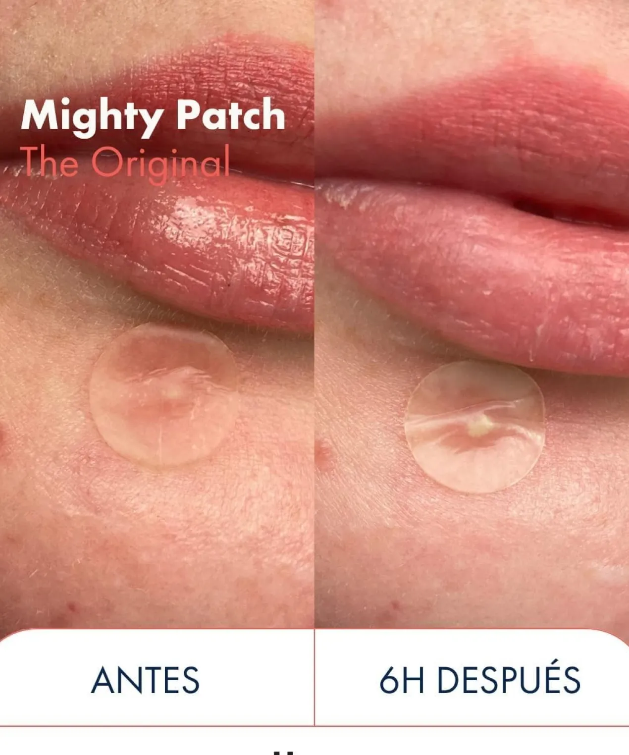 Mighty Patch The Original Patchs Hydrocolloïdes