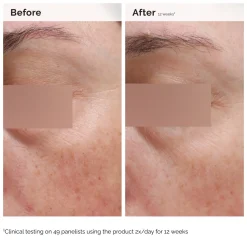 Niacinamide 5% Face & Body Emulsion