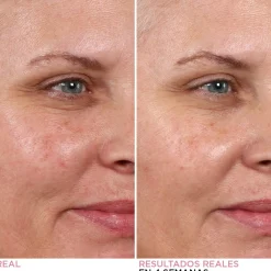 Peeling de Nuit Hello Results Baby