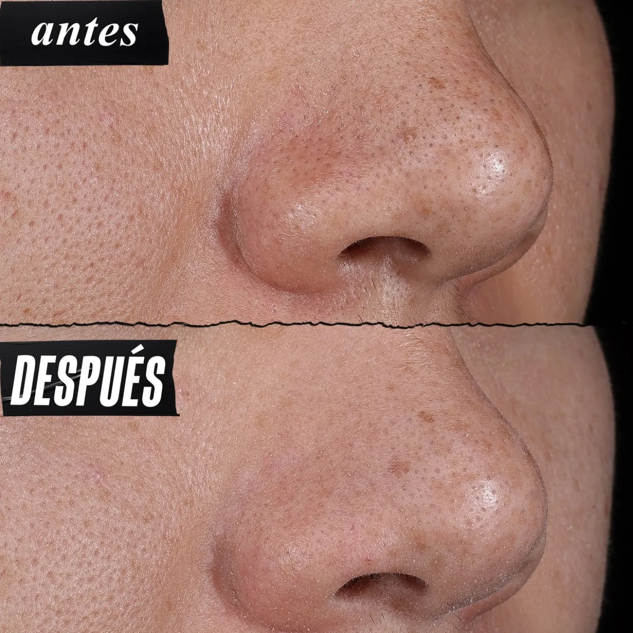 Rare Earth Masque Nettoyant Pores