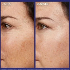 Revitalift Laser Sérum Nuit Rétinol Pur