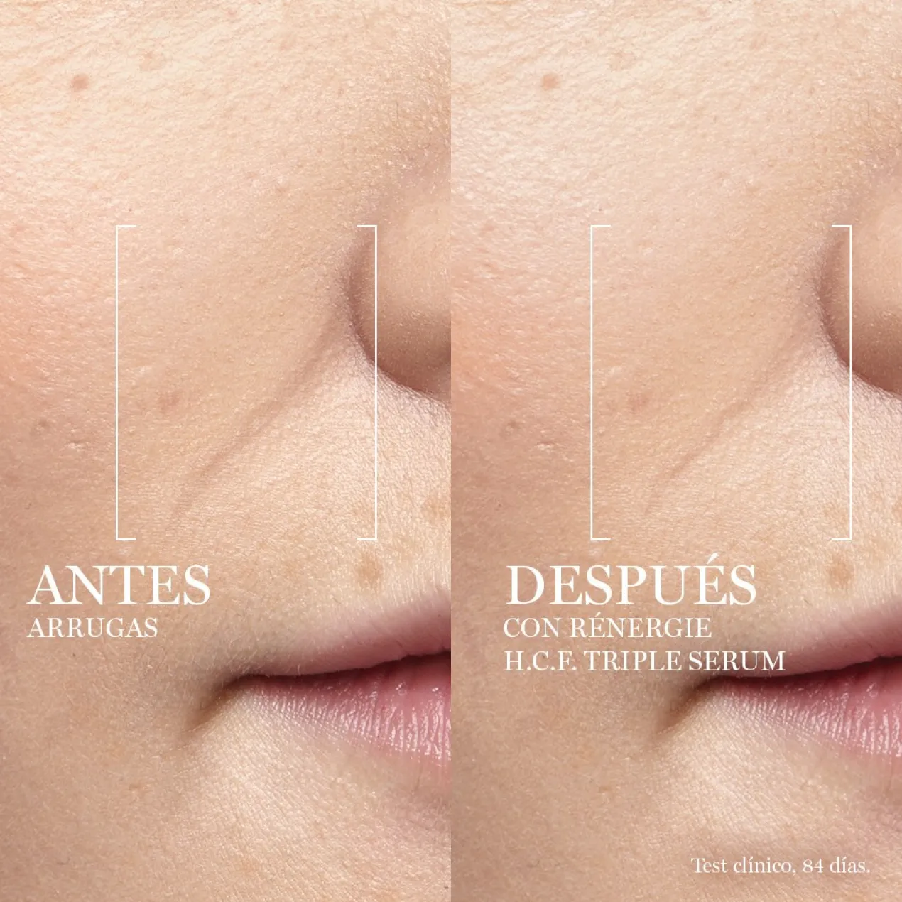 Rénergie H.C.F. Triple Serum