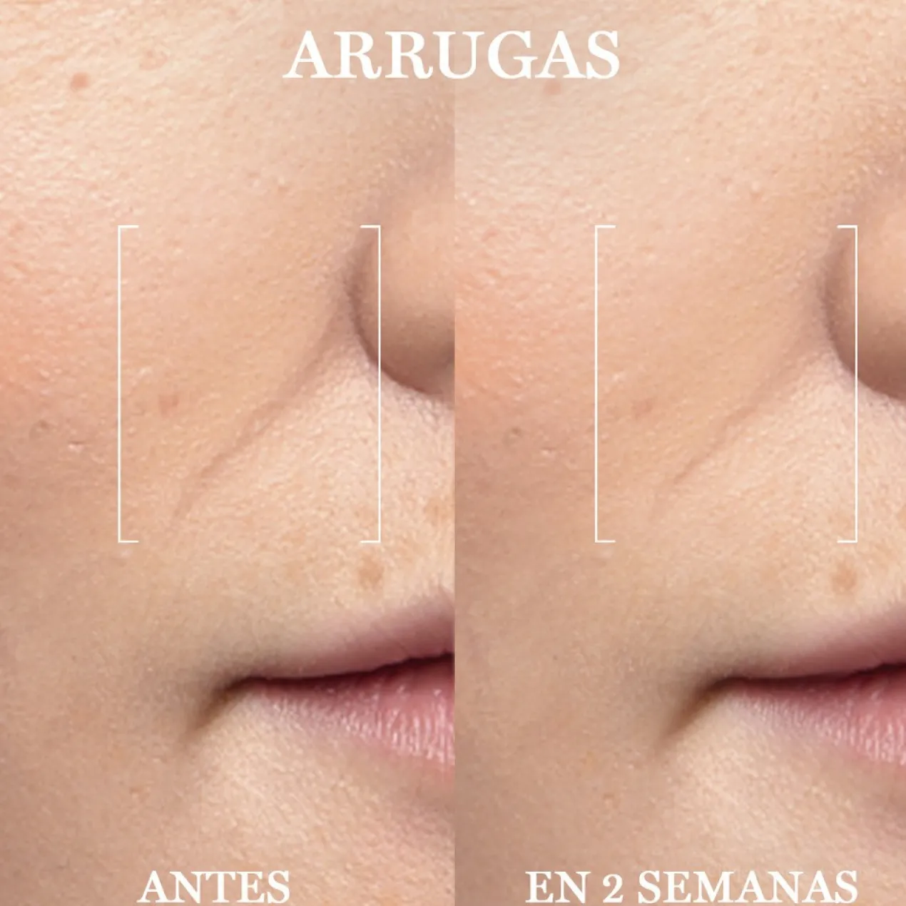Rénergie H.C.F. Triple Serum