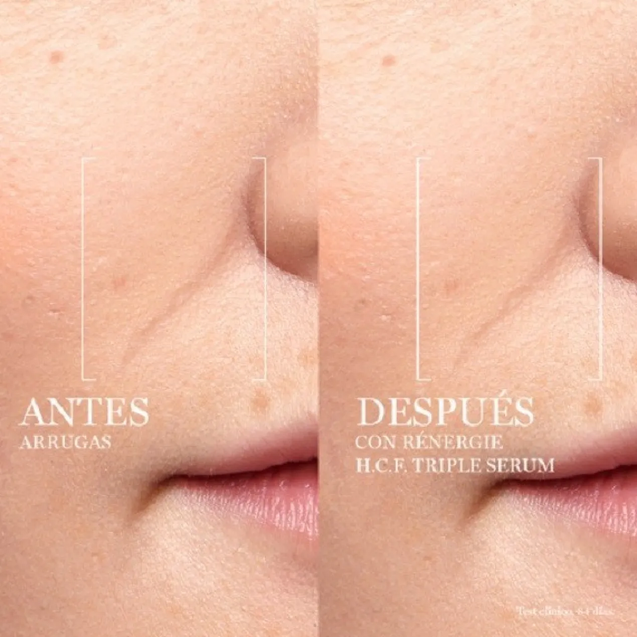 Rénergie H.C.F. Triple Serum