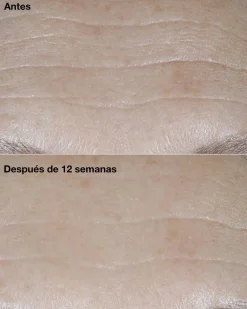 Smart Clinical Repair SPF30 Crème Correctrice de Rides