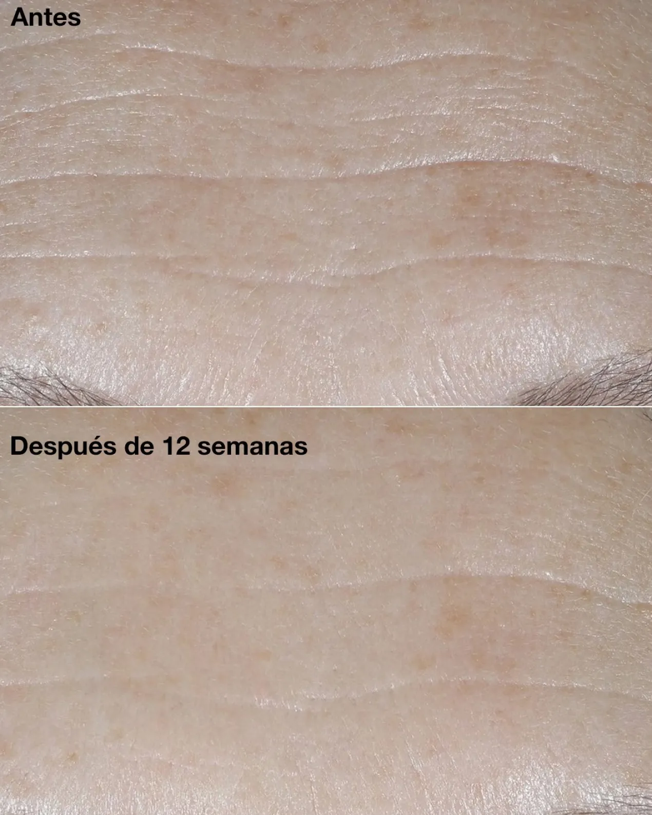 Smart Clinical Repair SPF30 Crème Correctrice de Rides
