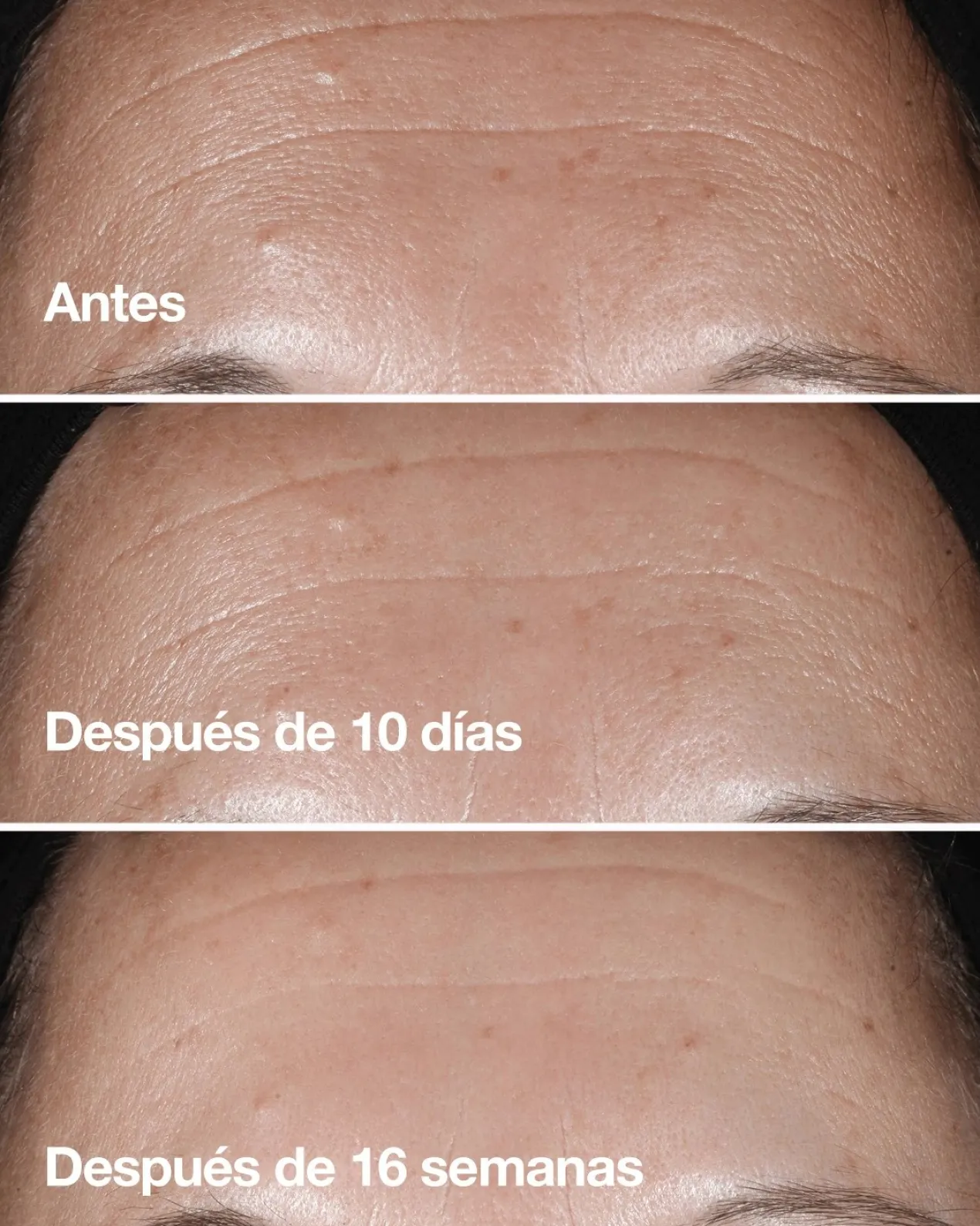 Smart Clinical Repair™ Sérum Correcteur de Rides