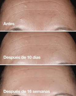 Smart Clinical Repair™ Sérum Correcteur de Rides