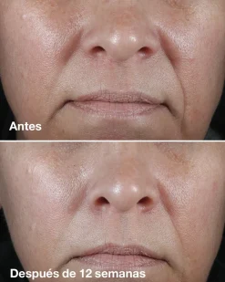 Smart Clinical Repair Wrinkle Correcting Crème Anti-rides