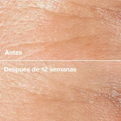 Smart Clinical Repair Wrinkle Correcting Crème Anti-rides
