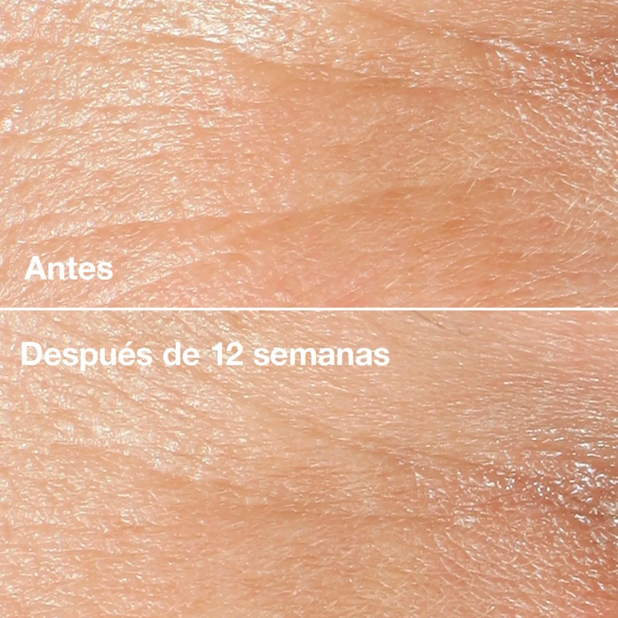 Smart Clinical Repair Wrinkle Correcting Crème Anti-rides