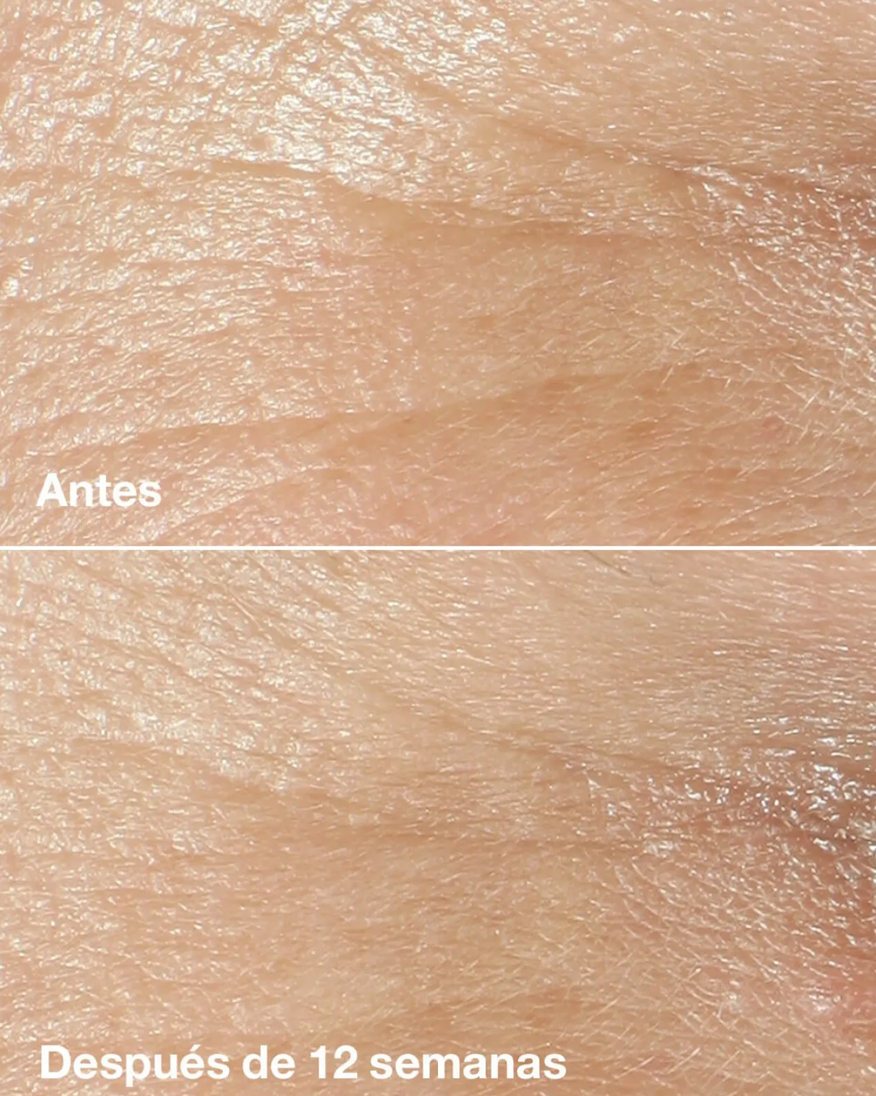 Smart Clinical Repair Wrinkle Correcting Crème Anti-rides