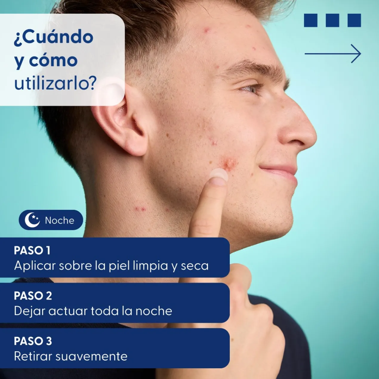 Spots Patchs Hydrocolloïde Microneedling Anti-Acné