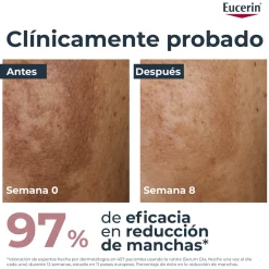 Sérum Anti-Taches Dual Anti-Pigment