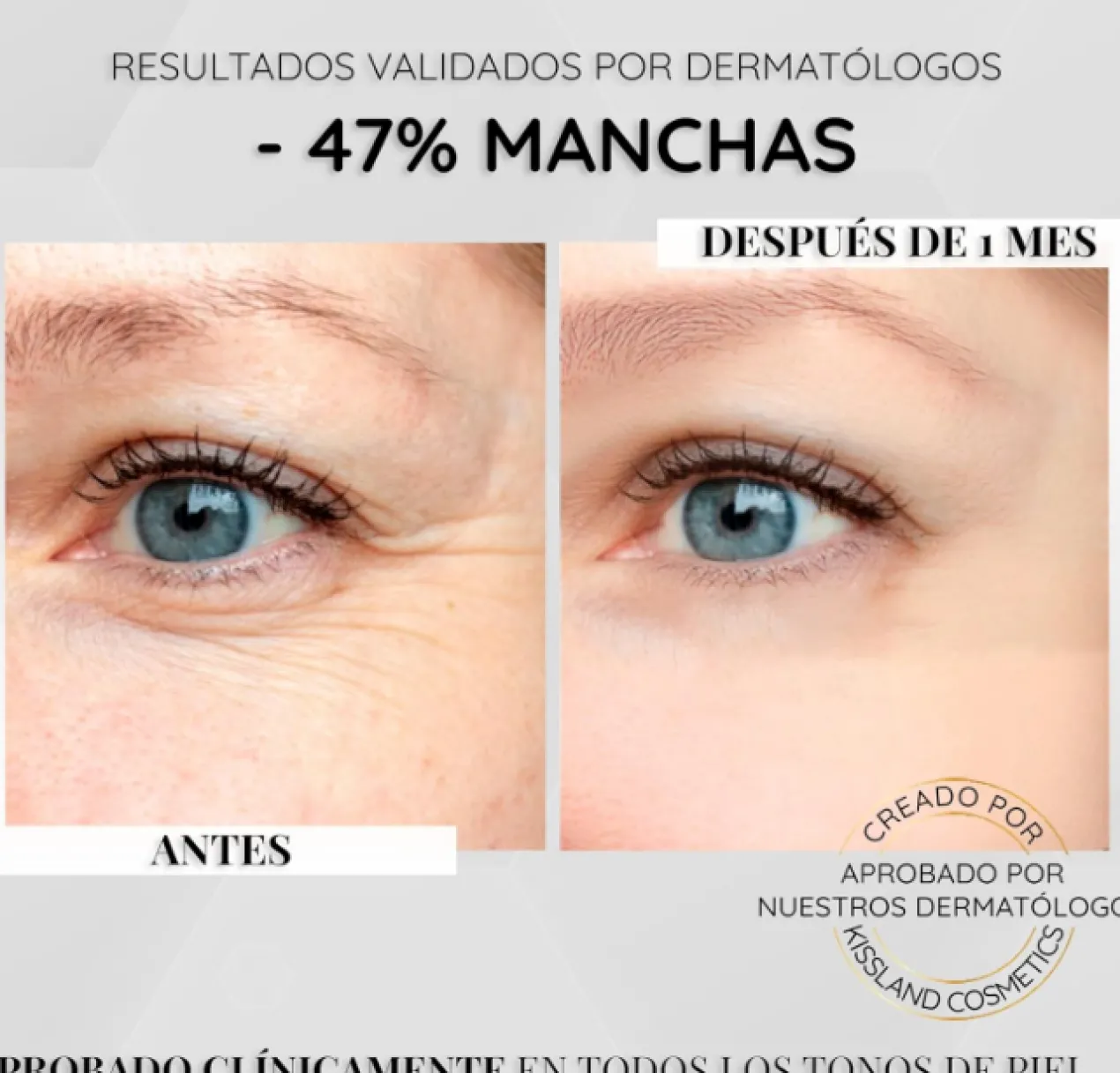 Sérum Anti-Taches Visage à la Niacinamide