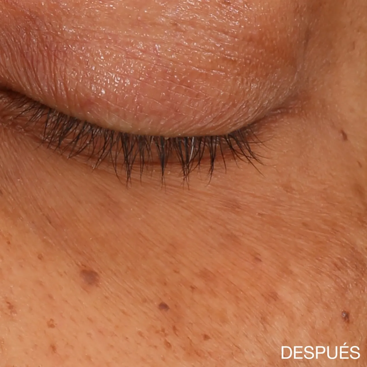 Sérum Concentré Illuminateur pour le Contour des Yeux