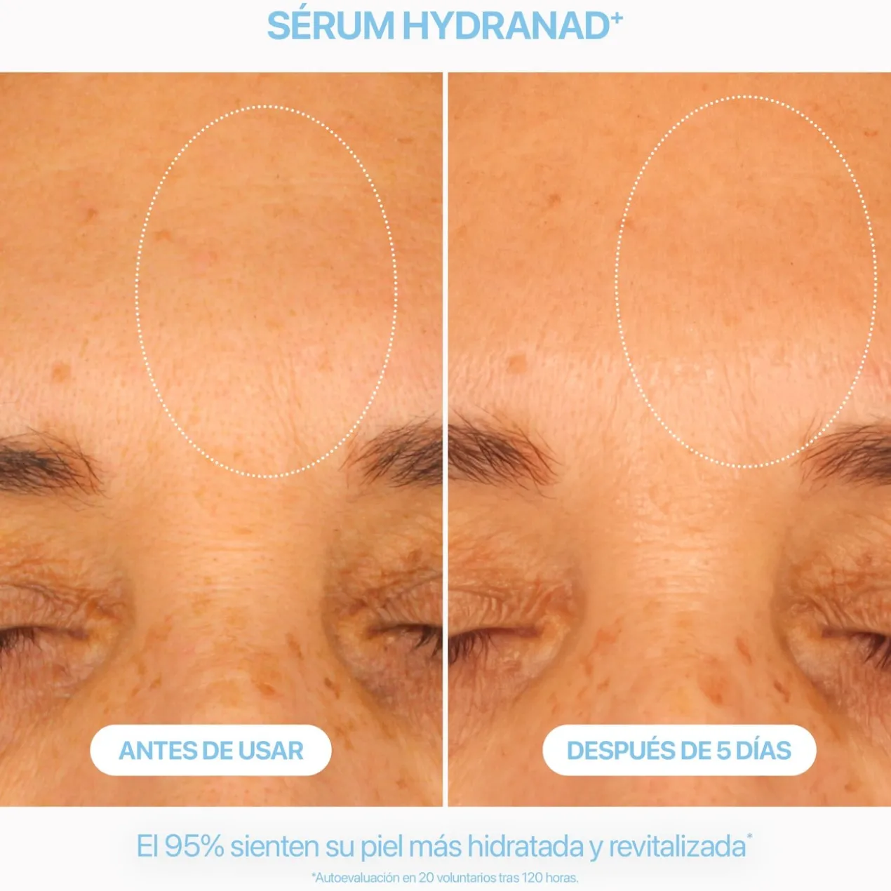 Sérum Hydranad+