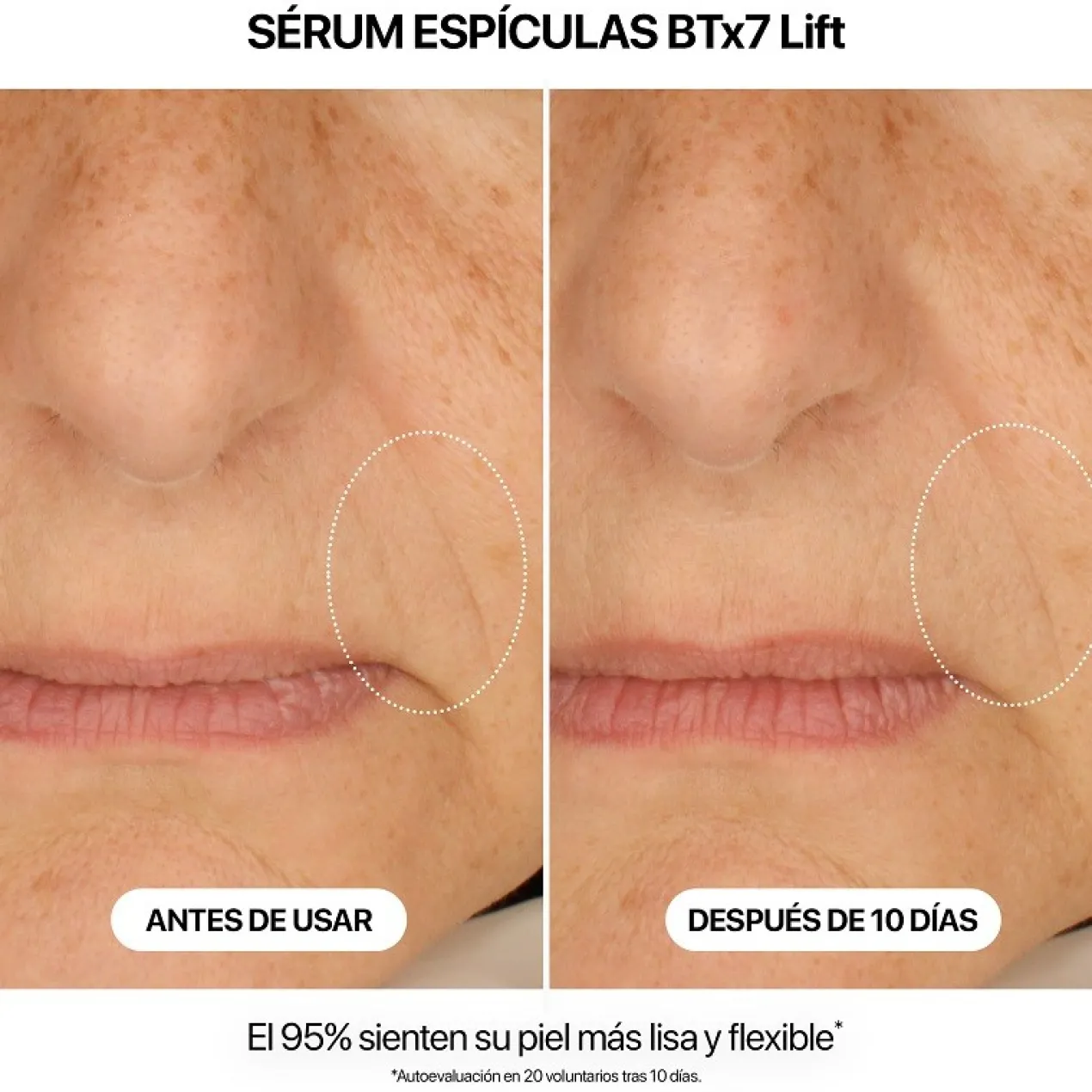 Sérum Spicules BTx7 Lift