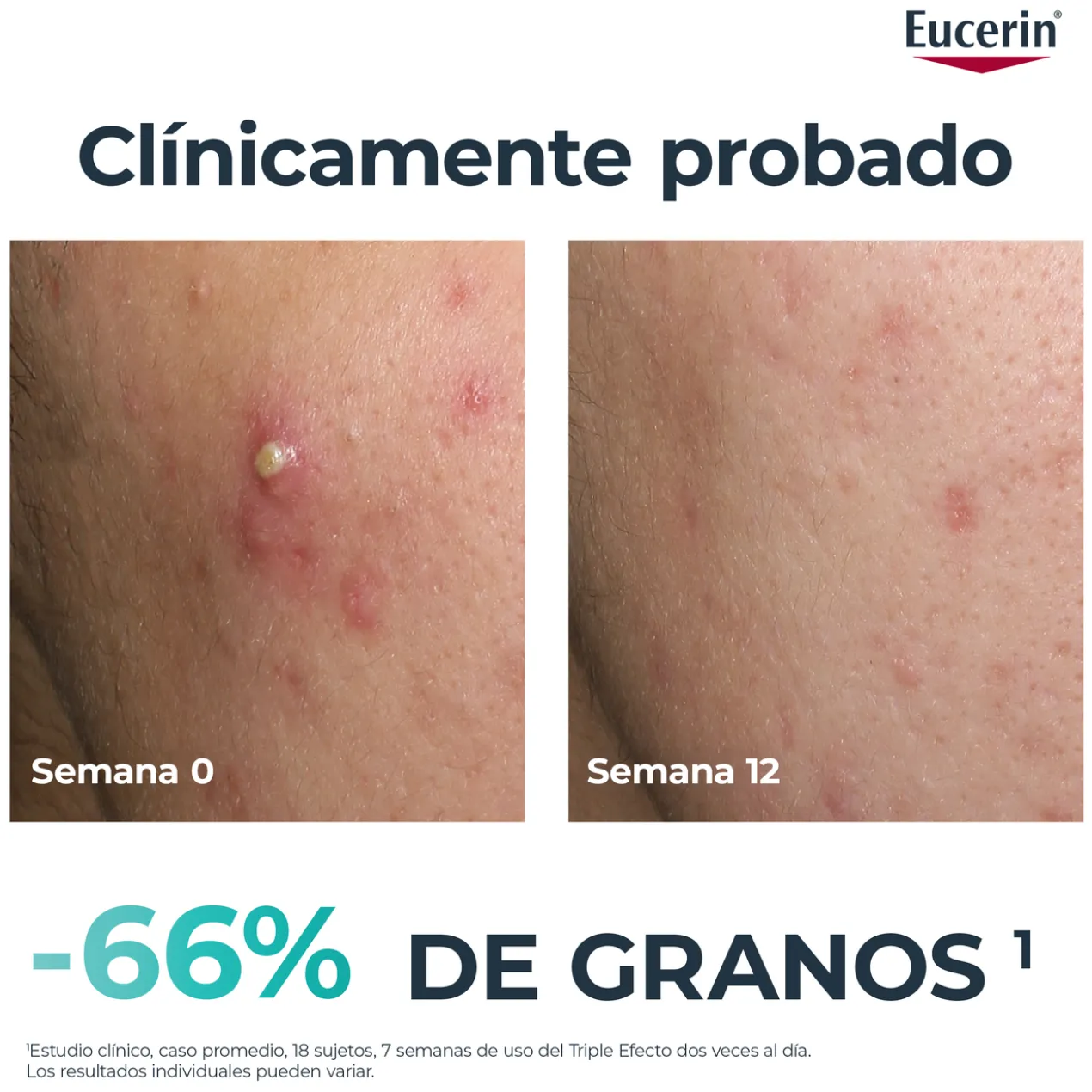 Sérum Triple Action DermoPure Clinical