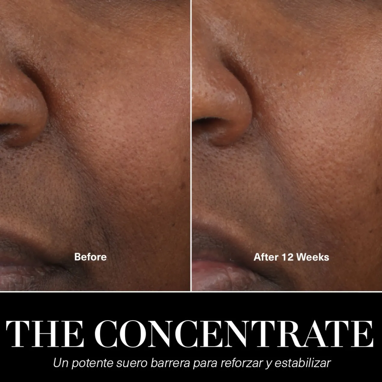 The Concentrate Sérum