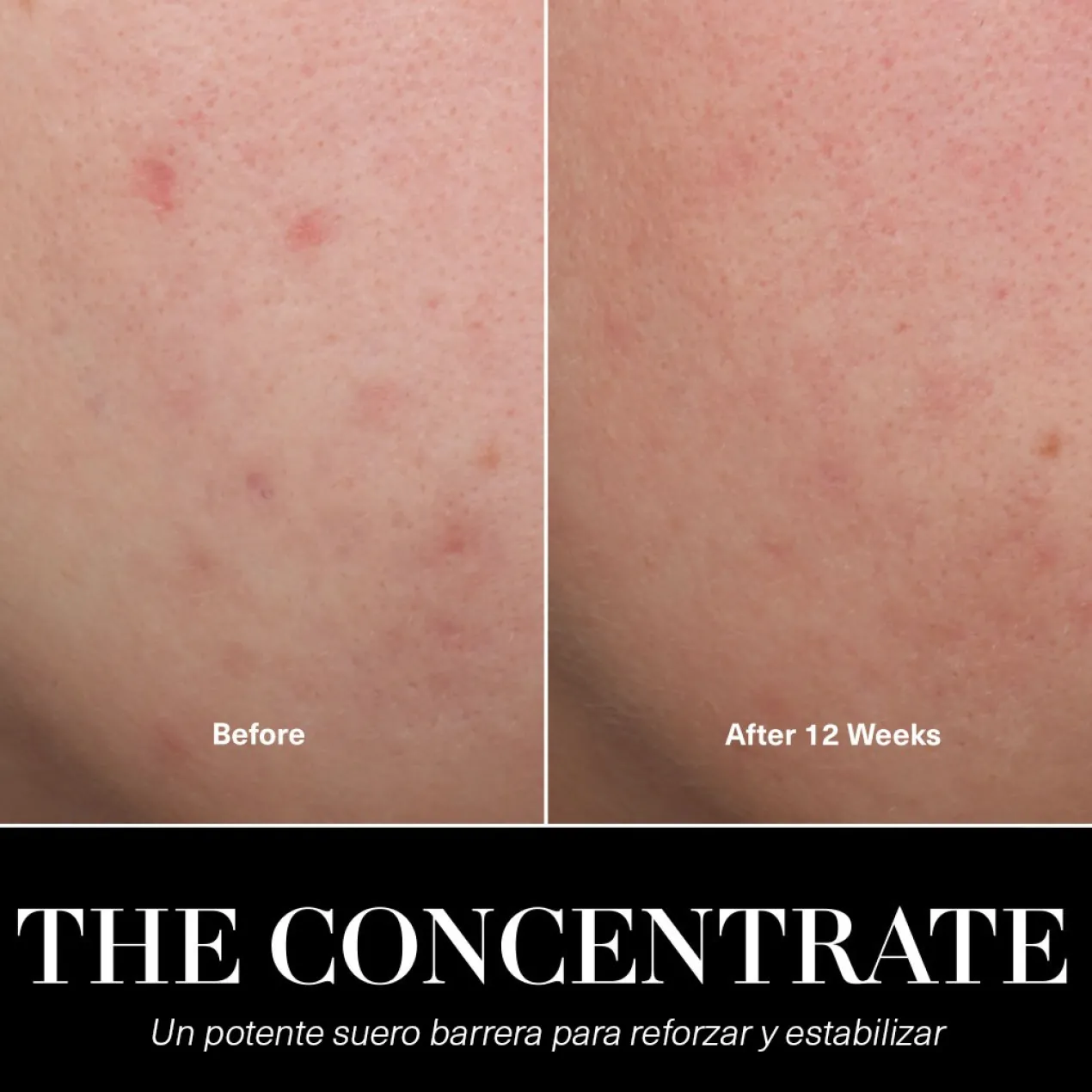 The Concentrate Sérum