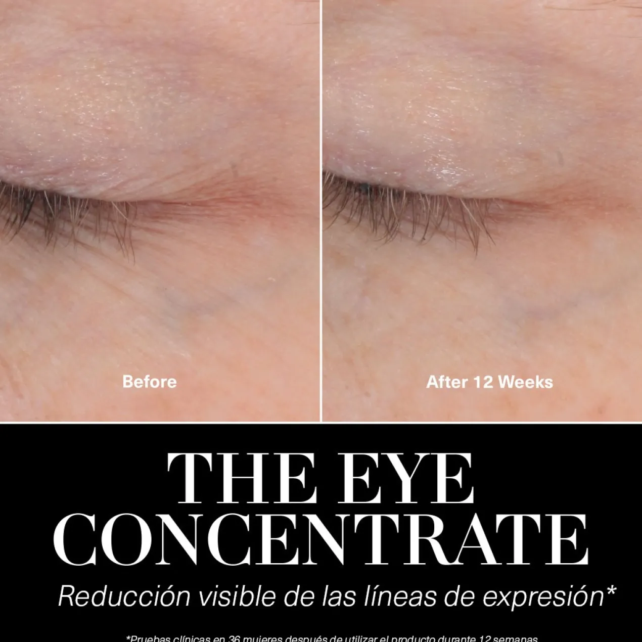 The Eye Concentrate Contour des Yeux Anti-Âge