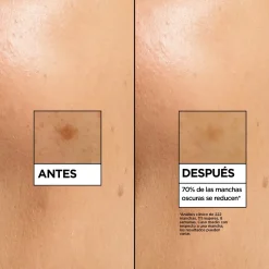 Vitamine C Sérum Anti-taches à 4 % de [Niacinamide + Vitamine C + Acide salicylique + Melasyl]